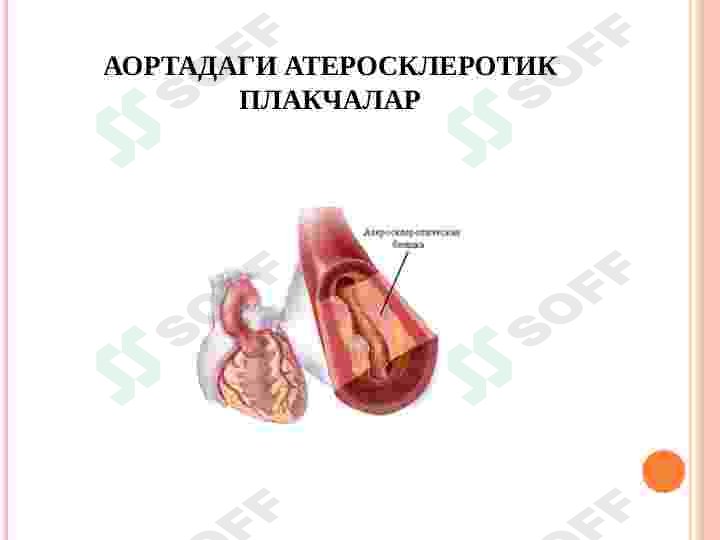 MIOKARD INFARKTI. STENOKARDIYALAR 6