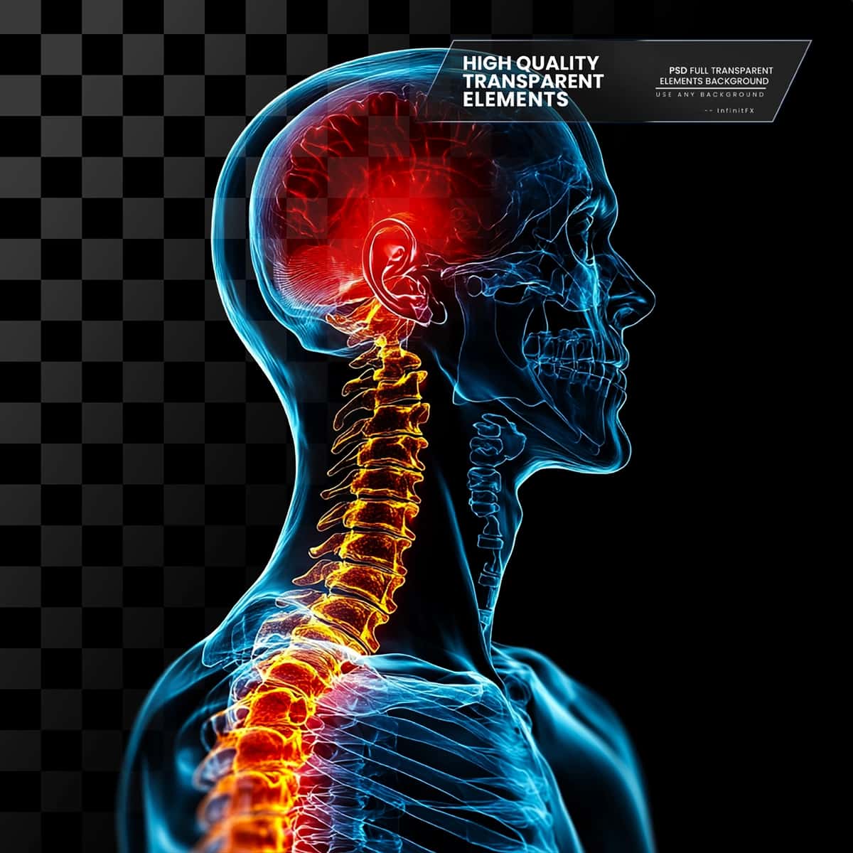 Ajratilgan joylar shaffof bo'yin og'rig'ini ko'rsatadigan grafik rentgen | Graphic xray showing neck pain with highlighted areas transparent 1