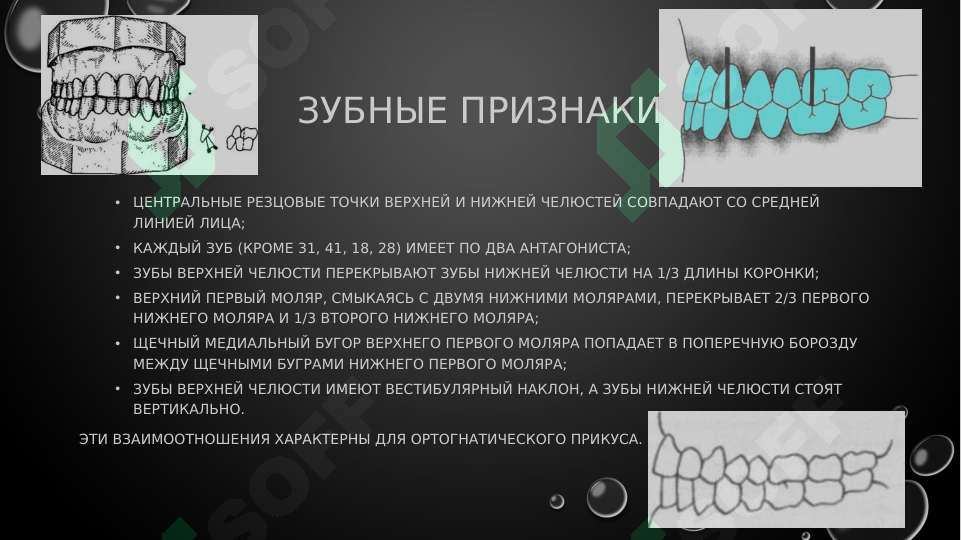 Preview 5