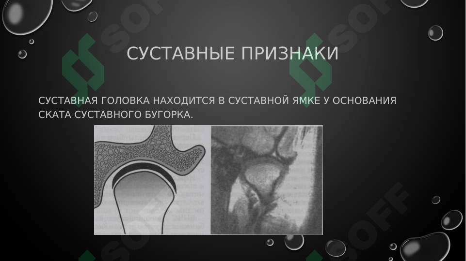 Preview 7