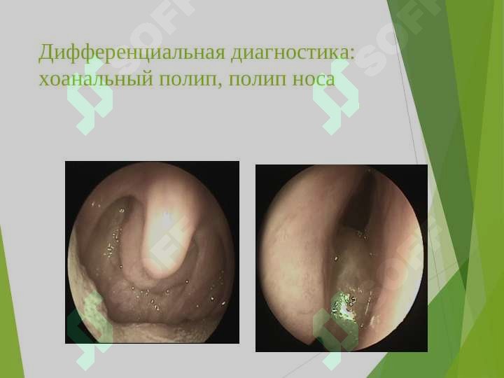 Preview 5