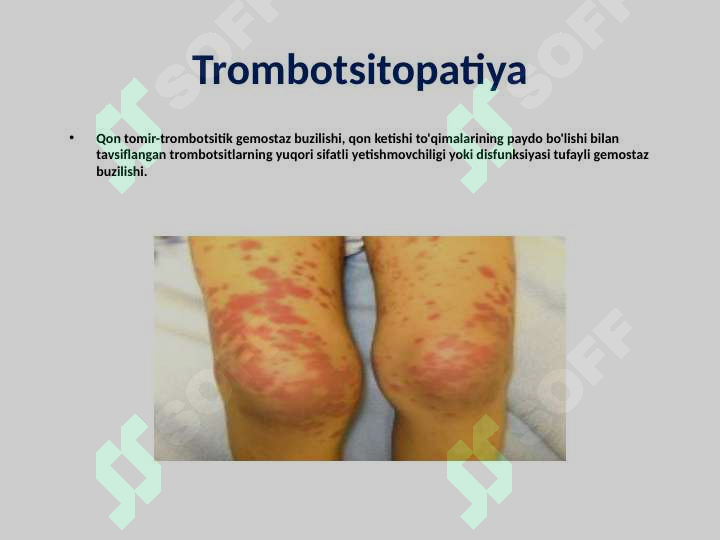 Preview 5