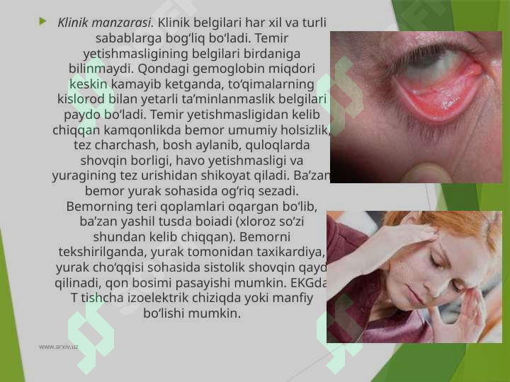 Preview 6