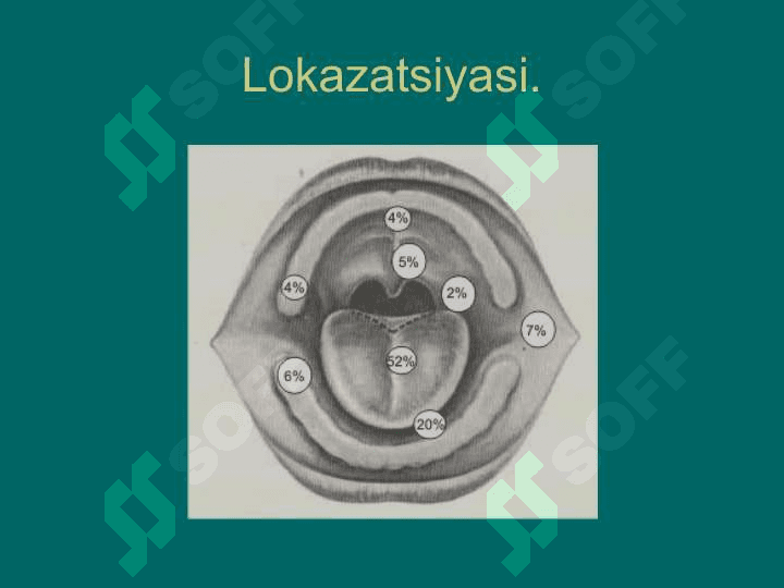 Til, lunj, tanglay va og'iz tubi o'smalari 2