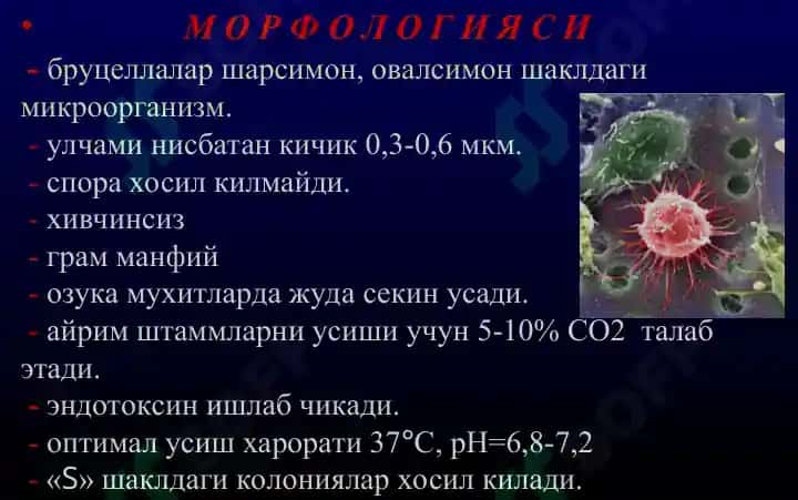 Бруцеллёз - Мальта иситмаси 5