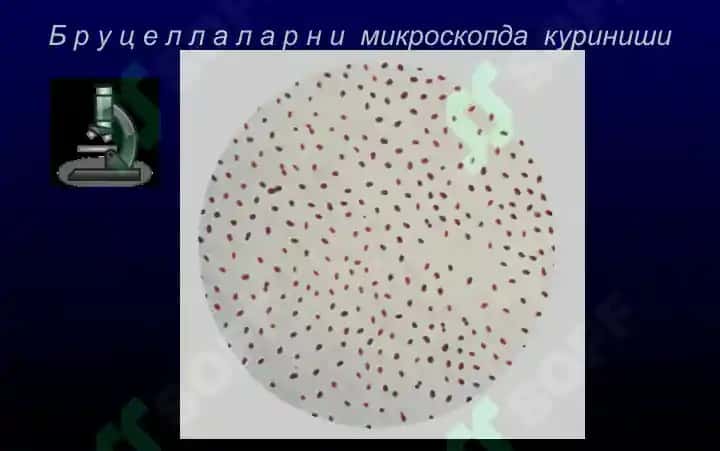 Бруцеллёз - Мальта иситмаси 6