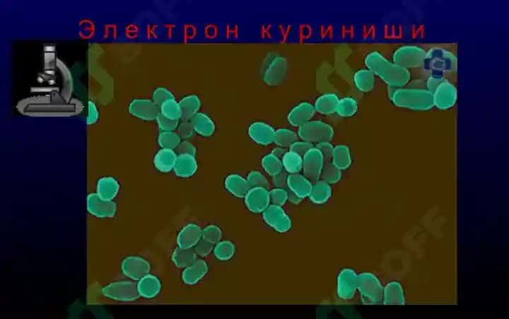 Бруцеллёз - Мальта иситмаси 7