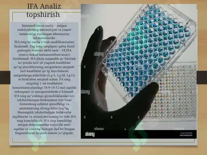 IFA, immunoblot, PZR, radioimmun reaksiyalarning yuqumli kasalliklar tashhisida qo‘llanilishi, qo‘yish tehnikasi 8