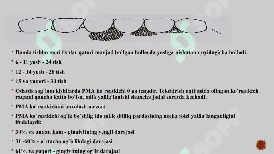 Parodont kasalliklari indekslari. JSST kriteriyalari. 4