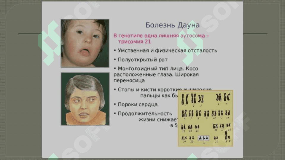 XROMOSOMA KASALLIKLARINING KELIB CHIQISH SABABLARI VA ASORATLARI 25 3