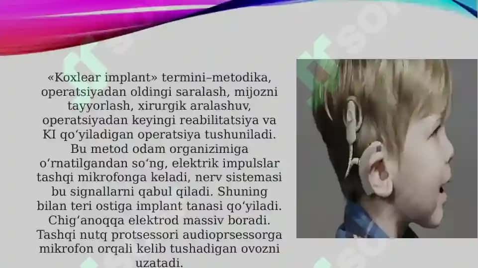 Koxlear implantli bolalarning eshituv-nutqiy reabilitatsiyasi bosqichlari tavsifi 4