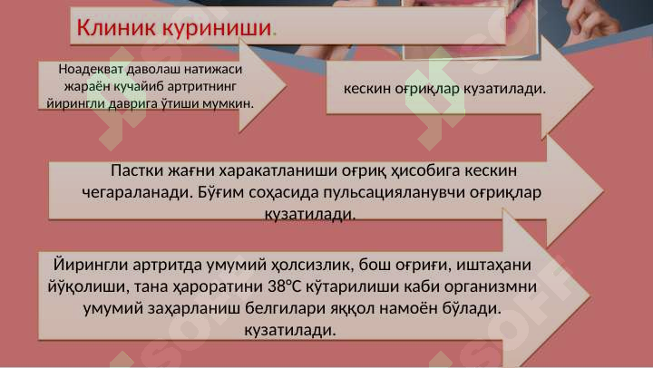 Preview 7