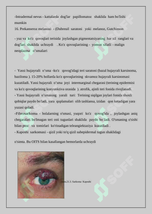 Preview 7