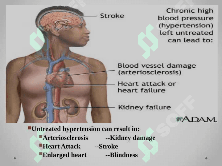 GIPERTONIYA KASALLIGI - ESSENTIAL HYPERTENSION 6