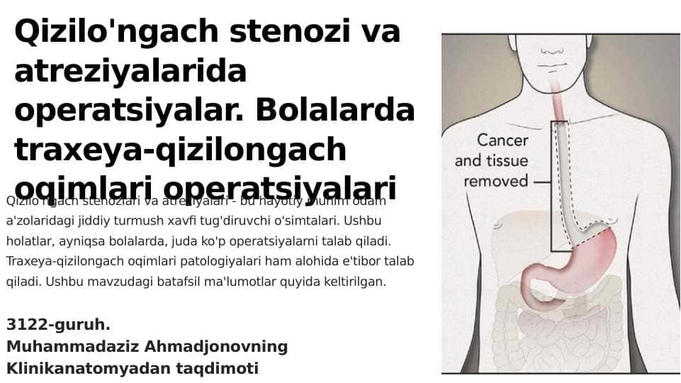 Qizilo'ngach stenozi va atreziyalarida operatsiyalar. Bolalarda traxeya-qizilongach oqimlari operatsiyalari