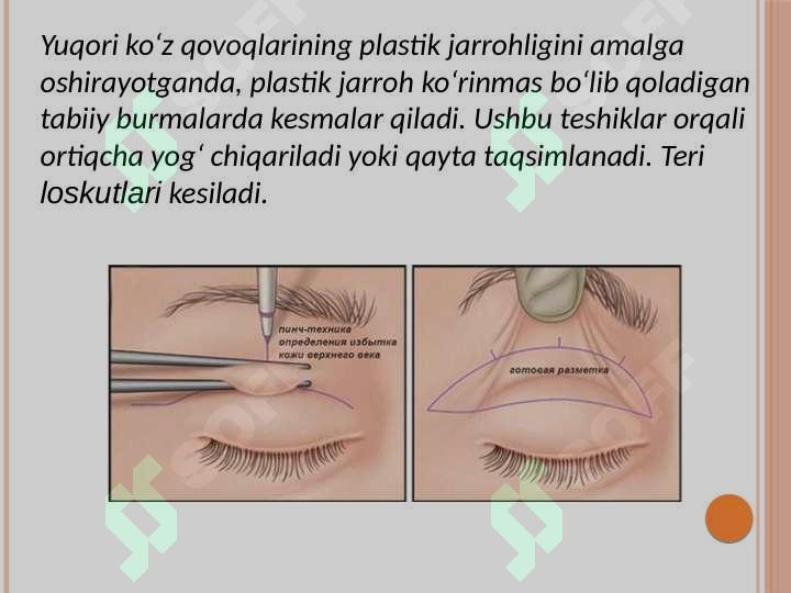 Preview 7