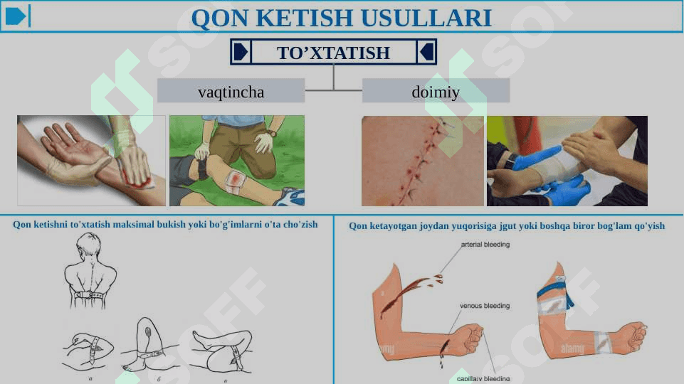 QON KETISHINI VAQTINCHA VA BATAMOM TO'XTATISH USULLARI - RASMLI 2
