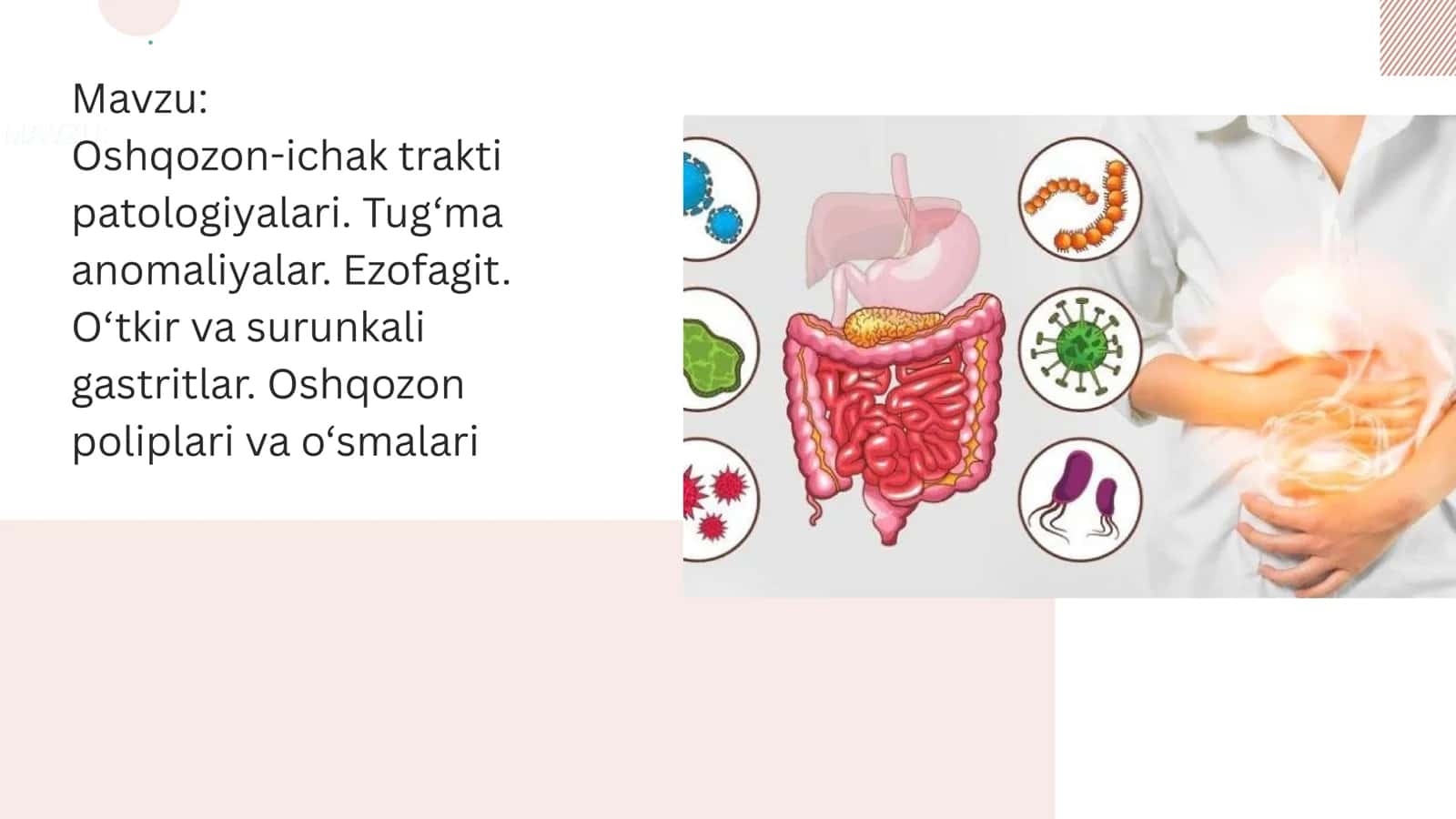 Oshqozon ichak tarkti patolohiyalari.Tug‘ma anomaliyalar. Ezofagit. O‘tkir va surunkali gastritlar. Oshqozon poliplari va o‘smalari 1