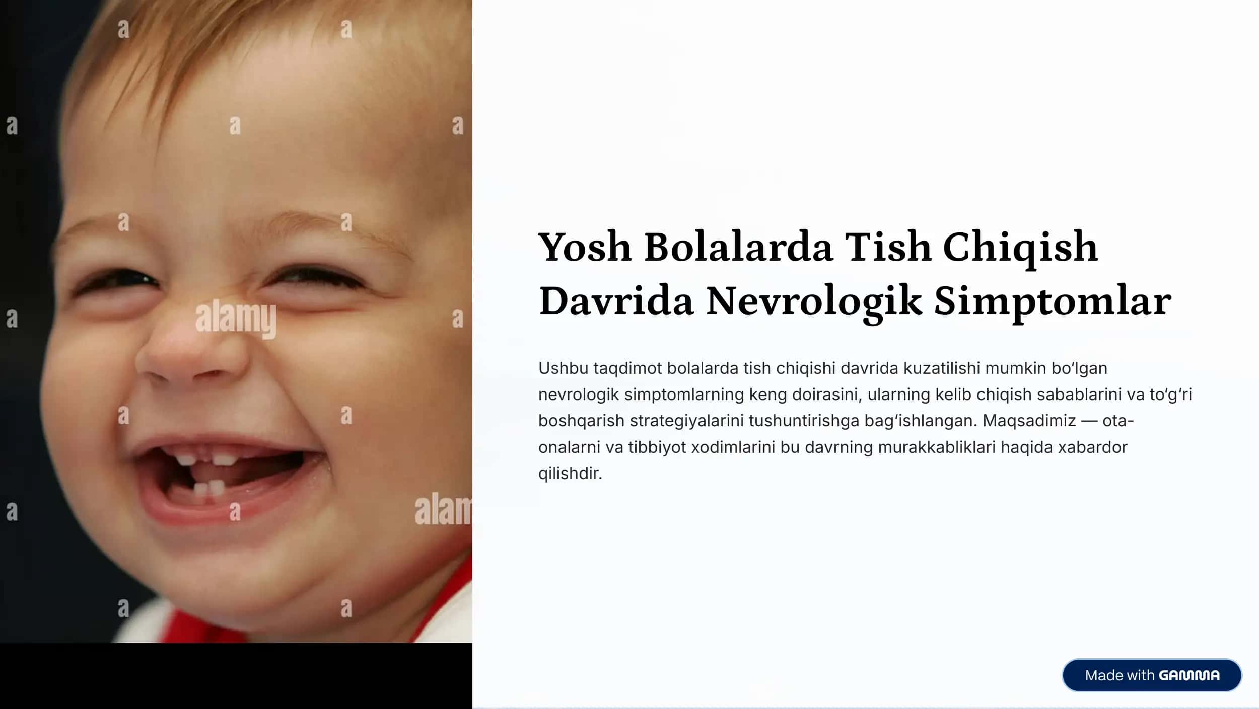 Yosh Bolalarda Tish Chiqish 
Davrida Nevrologik Simptomlar 1