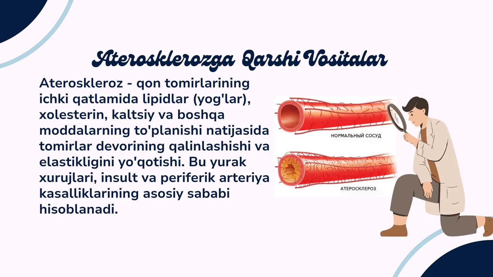 Aterosklerozga Qarshi Vositalar 2