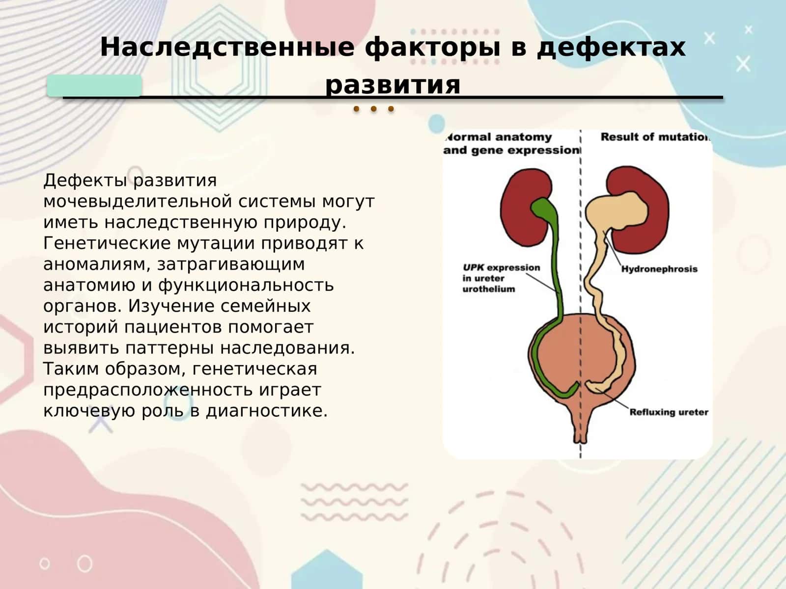 Дефекты развития мочевыделительной системы 2