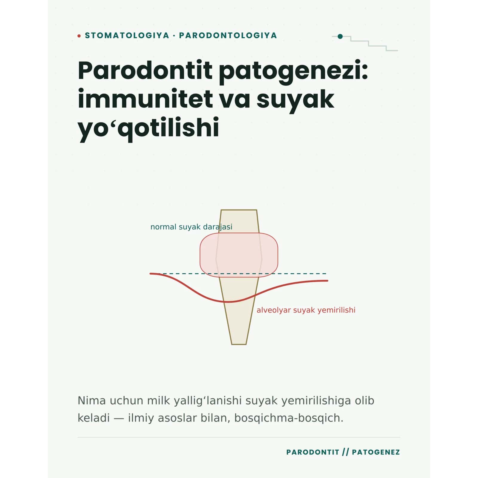 Parodontit nima va uning patalogiyasi 2