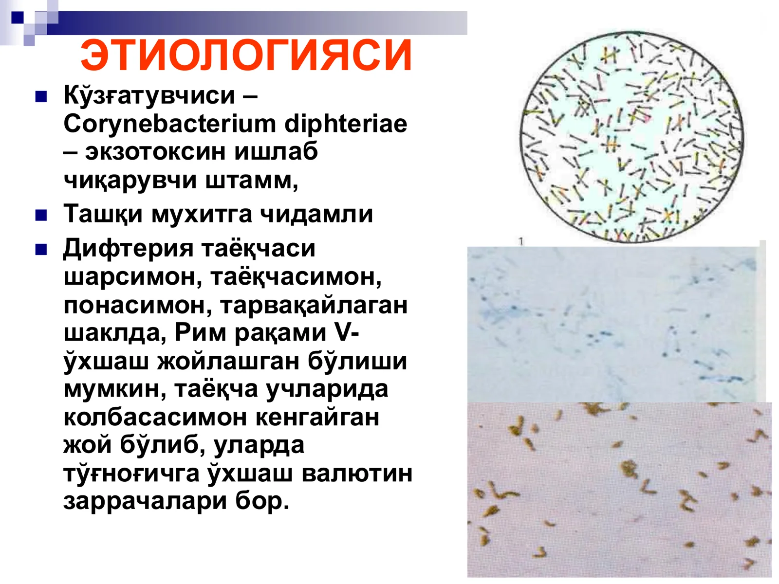 БЎҒМА – ДИФТЕРИЯ 2