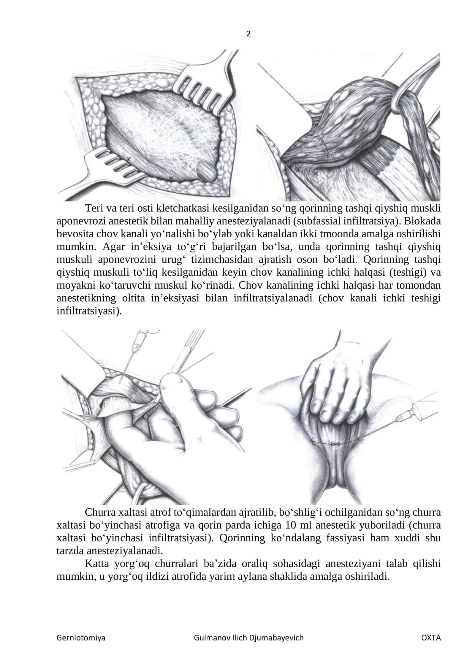 Gerniotomiya 2