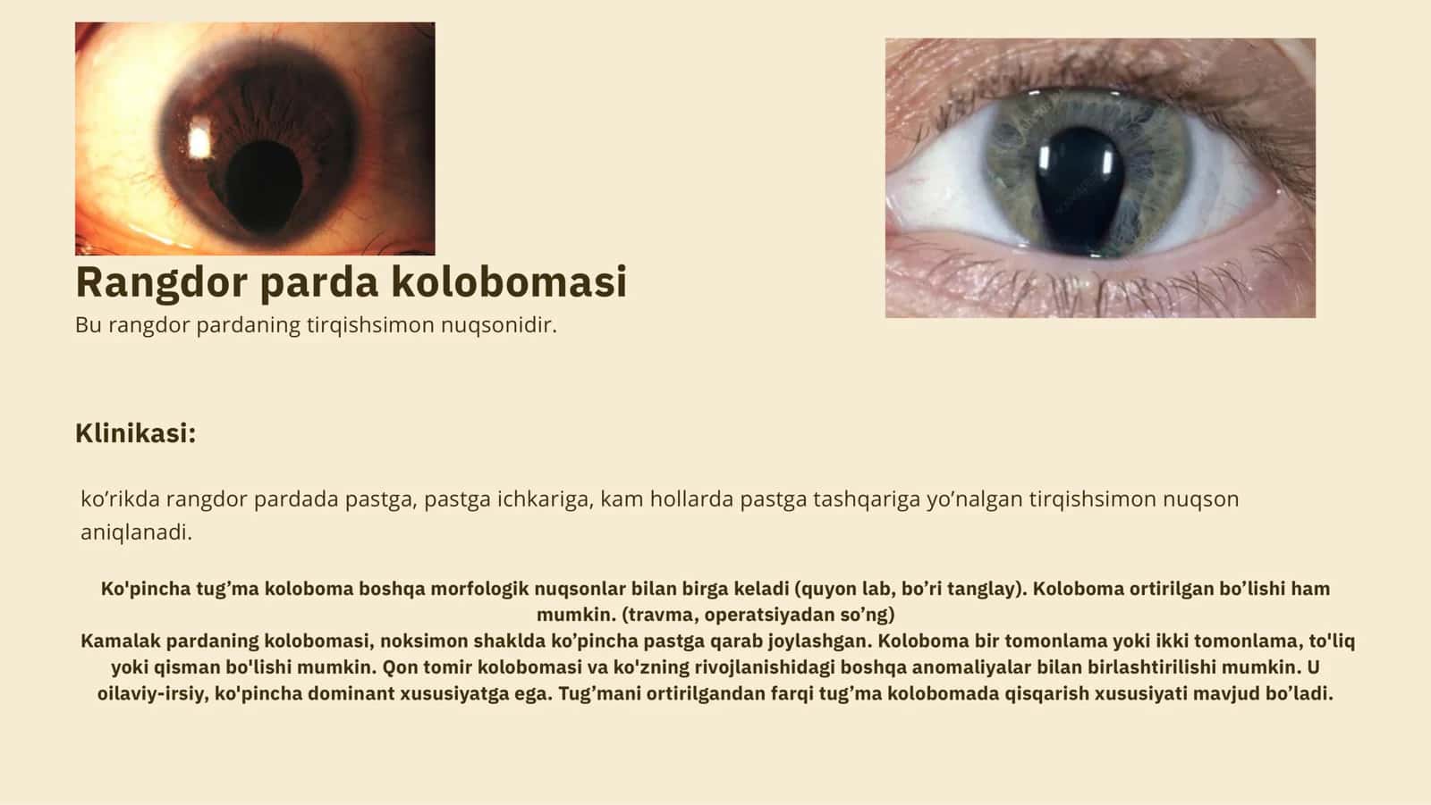Rangdor parda anomaliyalari 3