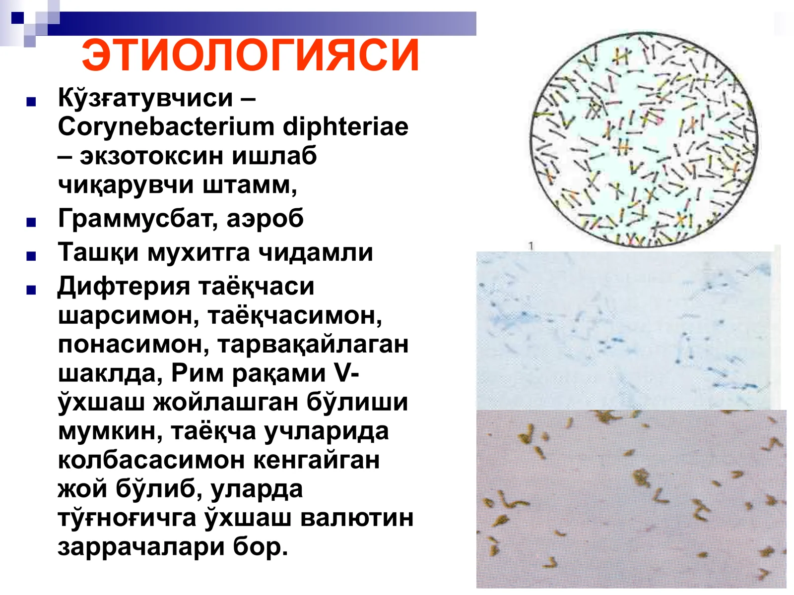 БЎҒМА – ДИФТЕРИЯ 3