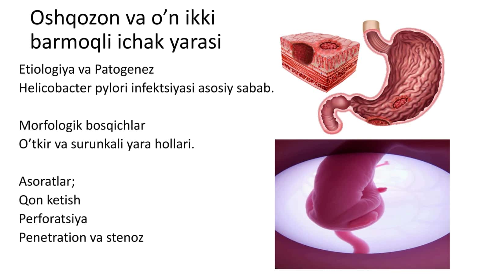 Qorin kasalliklari: Patologik anatomiya 3