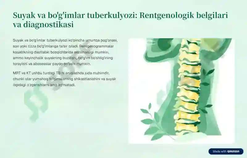 O'pkadan tashqari tuberkulyozning Rentgenologik va nurdiagnostikasi 4