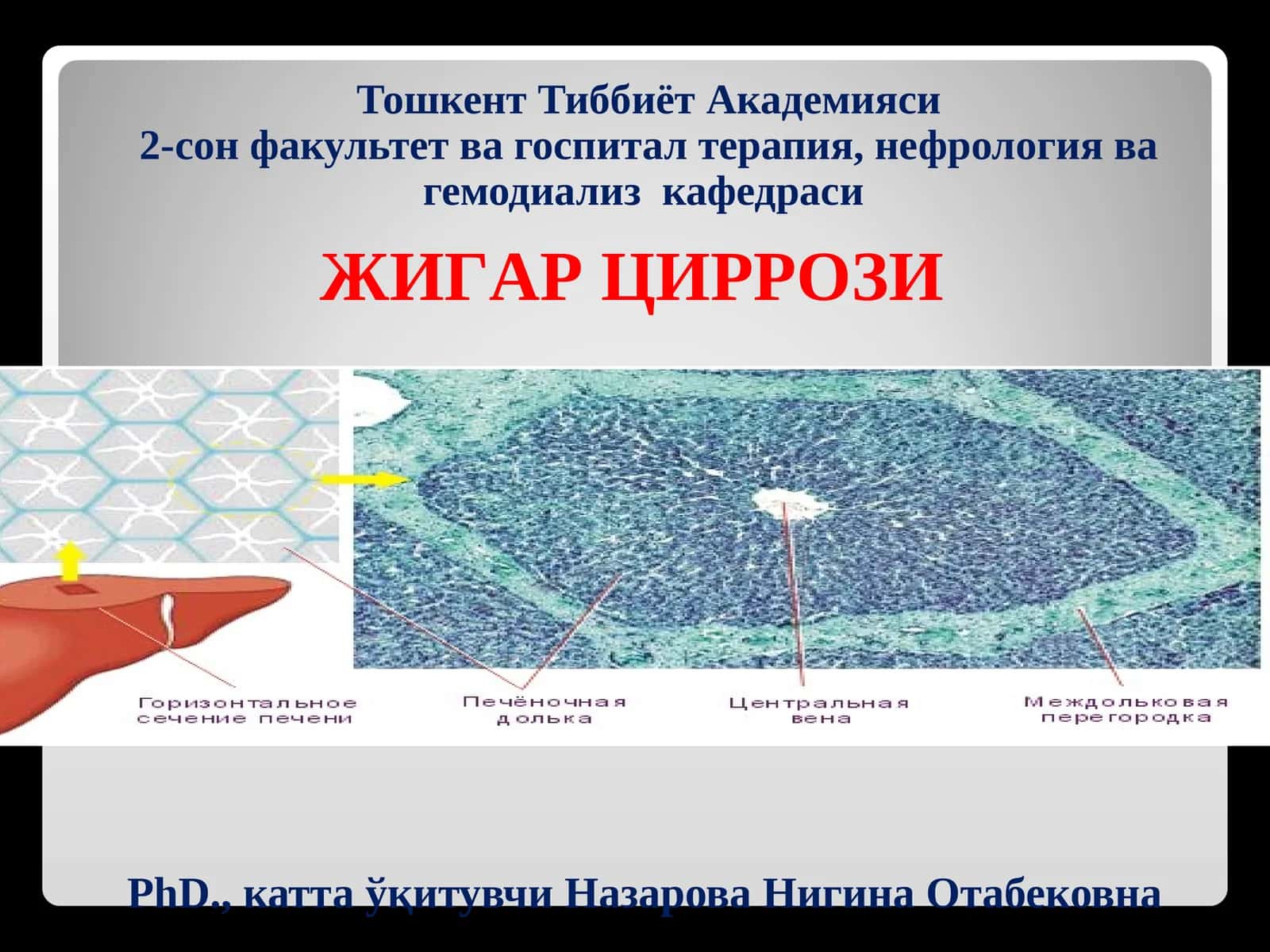 ЖИГАРЦИРРОЗИ 1