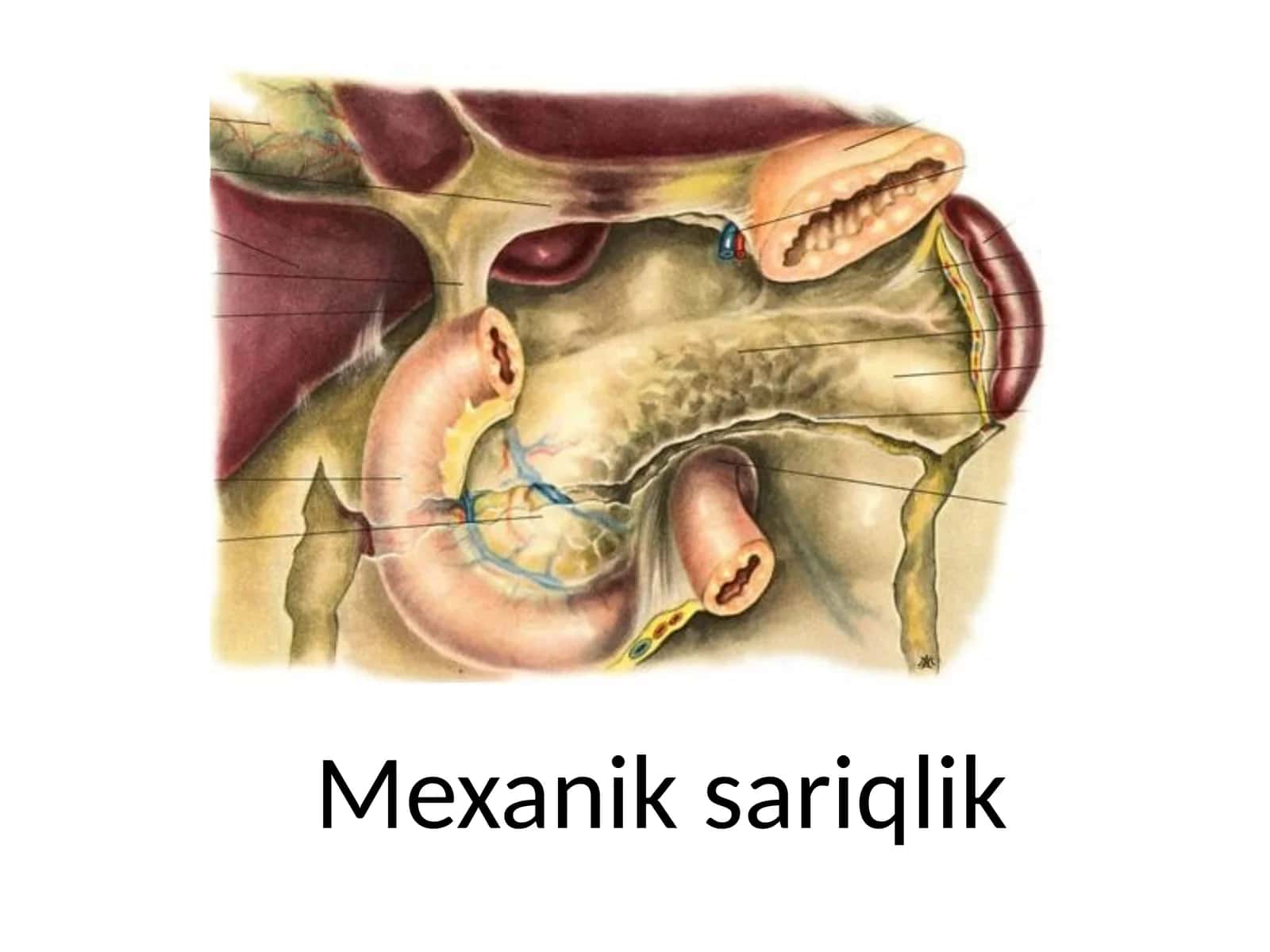 Mexanik sariqlik 1