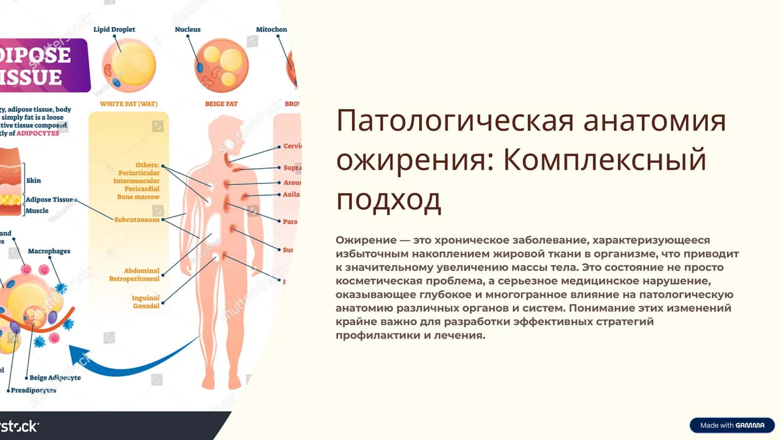 Патологическая анатомия ожирения: Комплексный подход 1