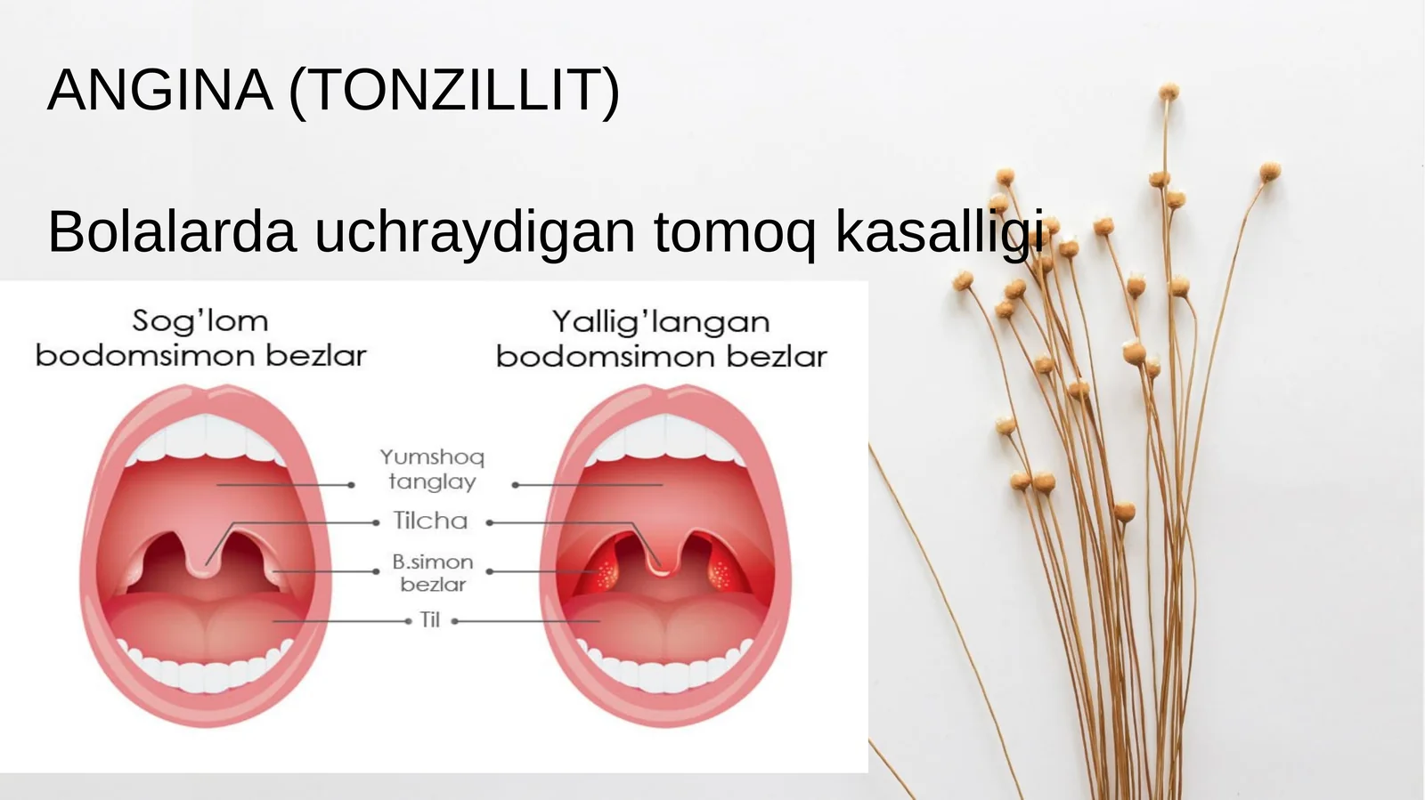 Angina(Tonzillit) 1