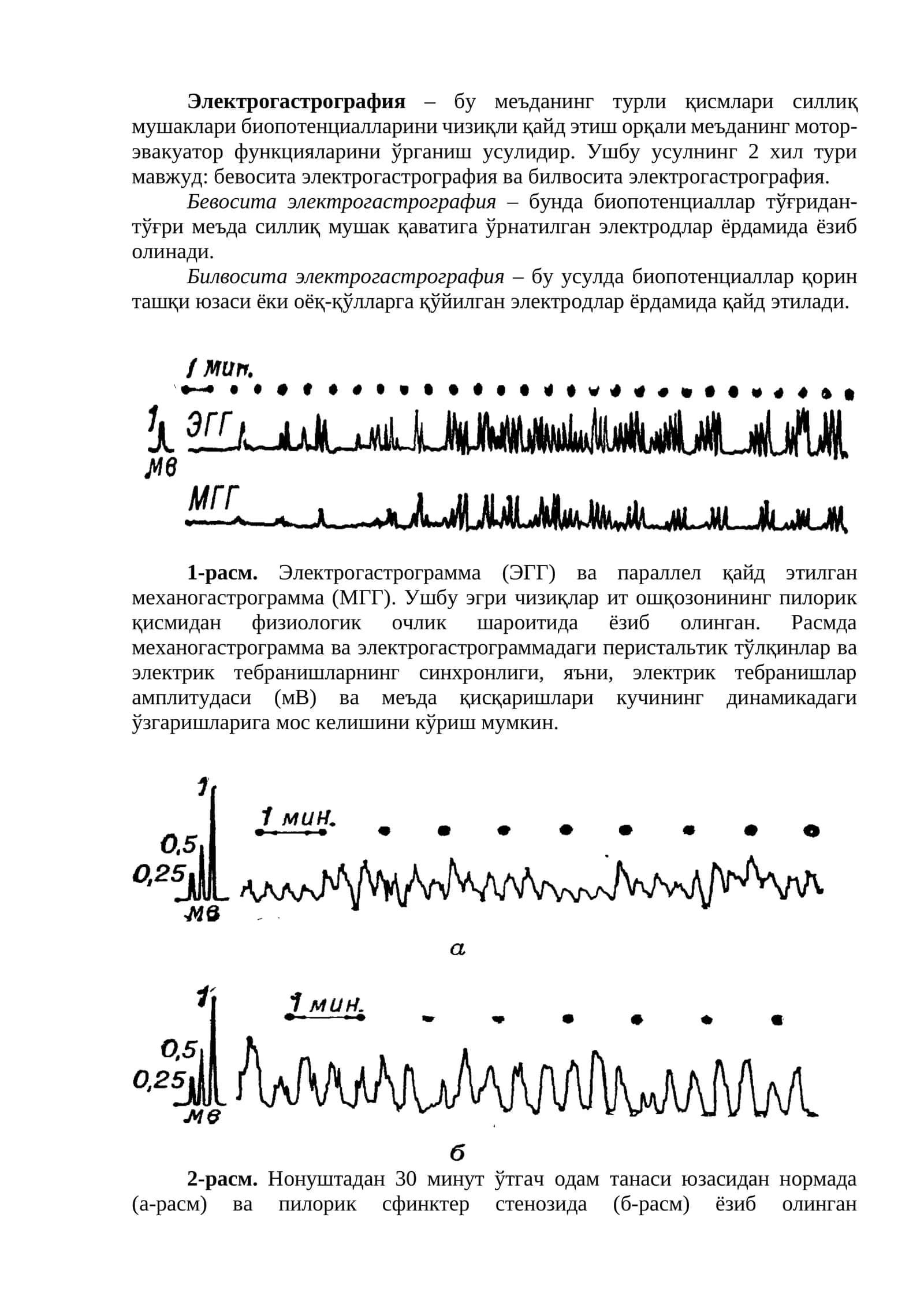 Электрогастрография 1