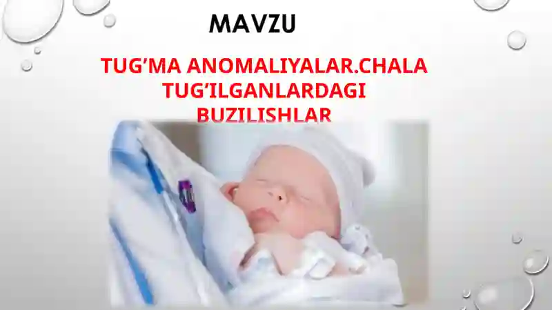 Tug’ma Anomaliyalar. Chala tug’ilganlardagi buzilishlar