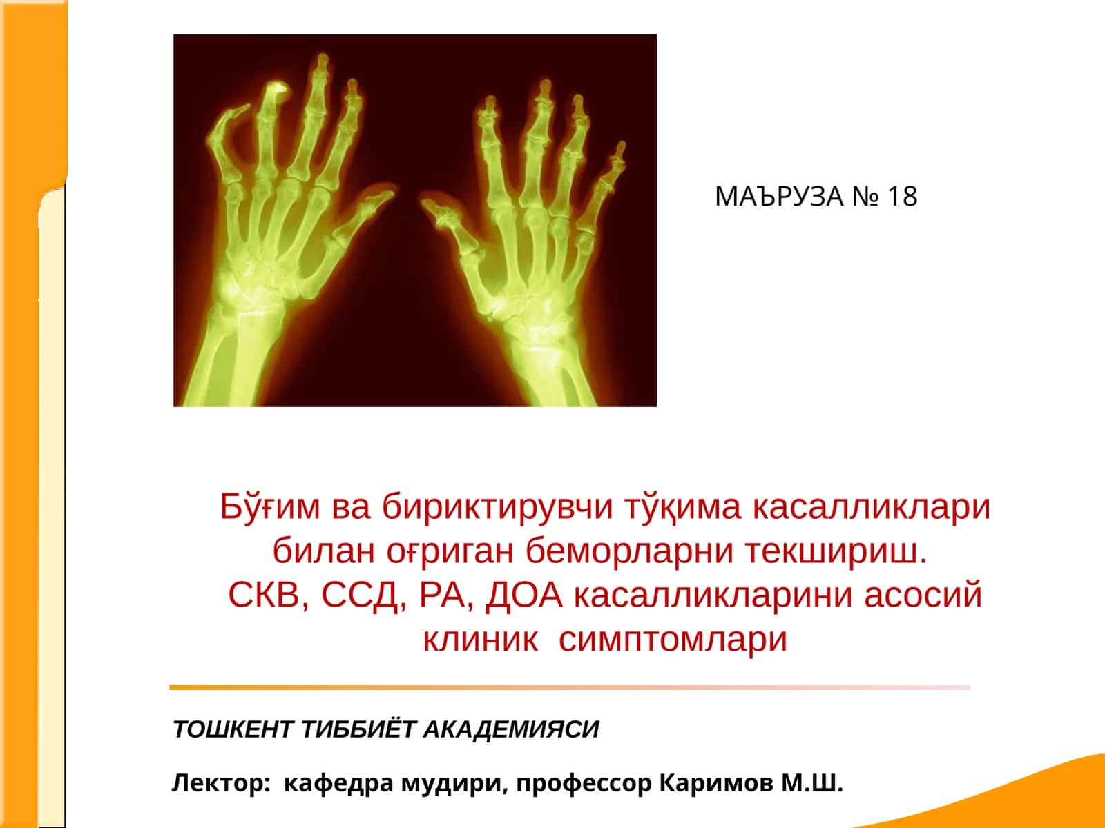 Системали кизил волчанка 1