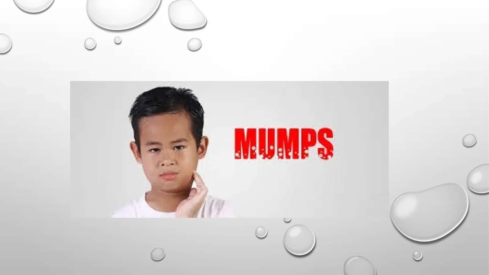 Mumps 1