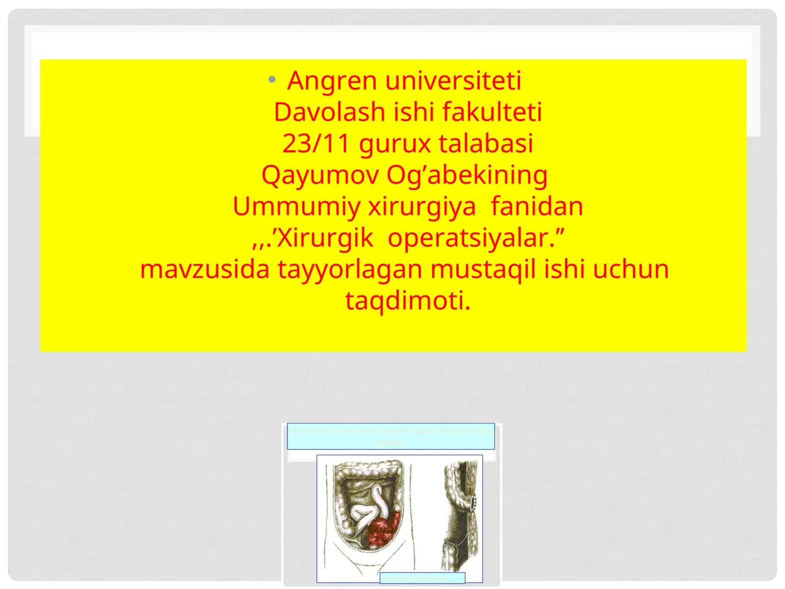 Xirurgik operatsiyalar 1