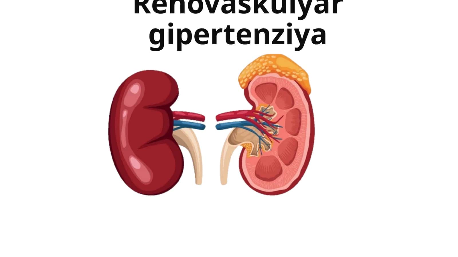 Renovaskulyar gipertenziya 1