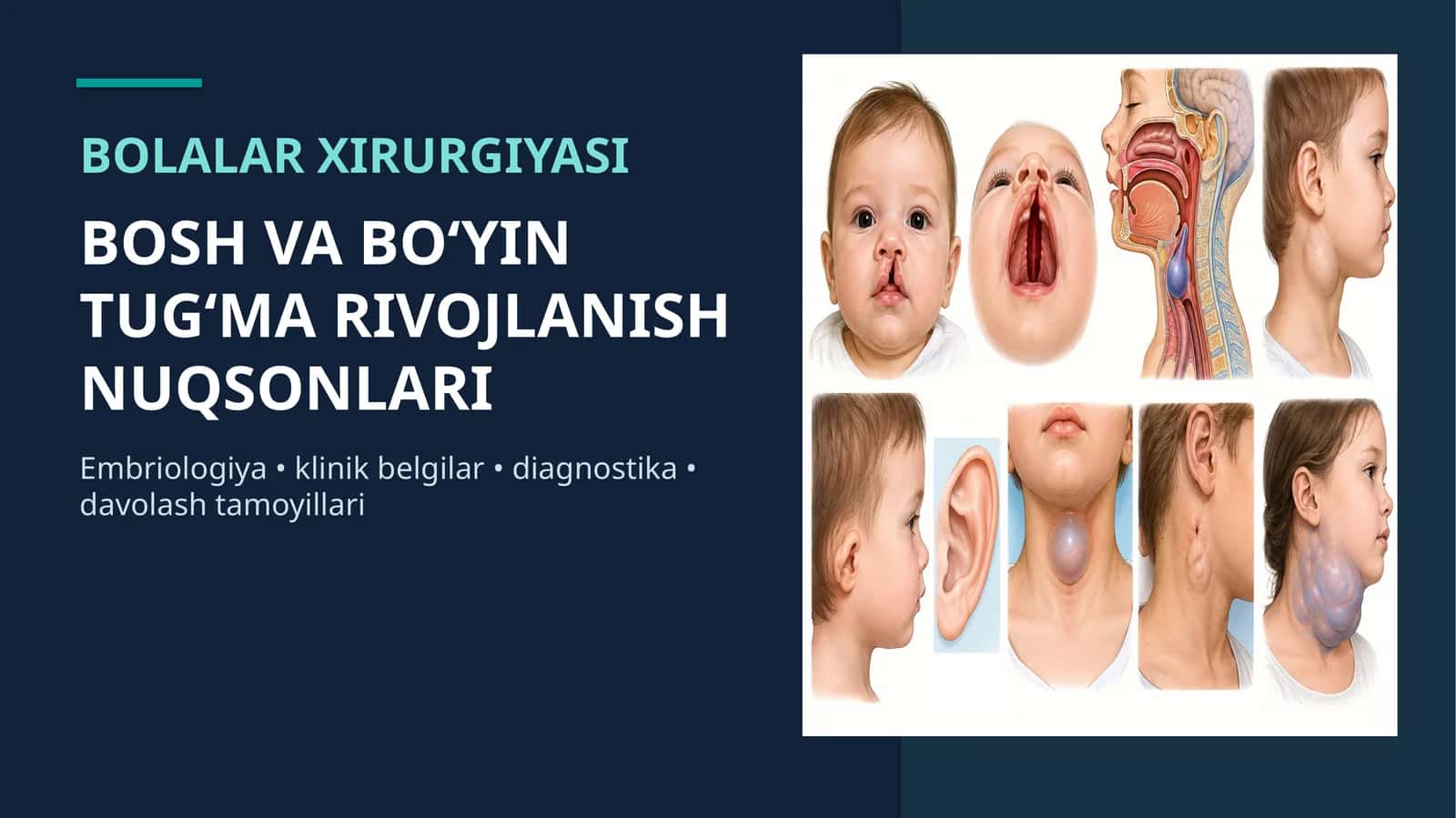 Bolalarda bosh va bo`yin tug`ma nuqsonlari 1