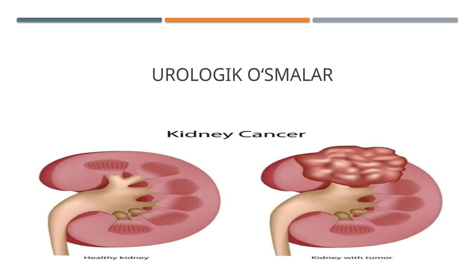 UROLOGIK O‘SMALAR 1