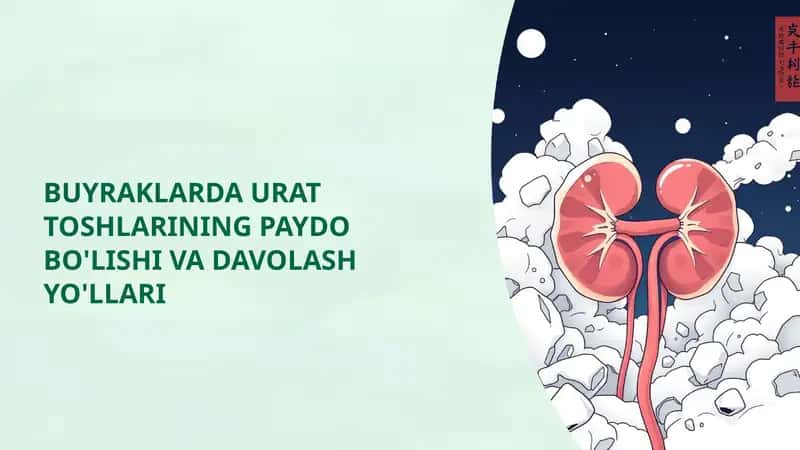 BUYRAKLARDA URAT TOSHLARINING PAYDO BO'LISHI VA DAVOLASH YO'LLARI 1