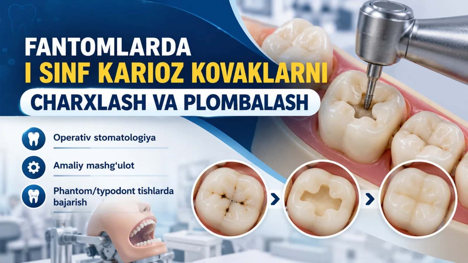 Fantomlarda I sinf karioz kovaklarni charxlash va plombalash.pptx 1