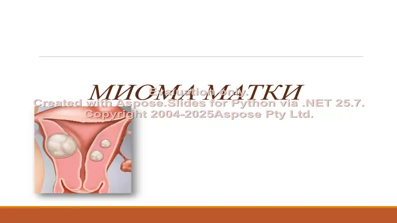 Миома матки 1