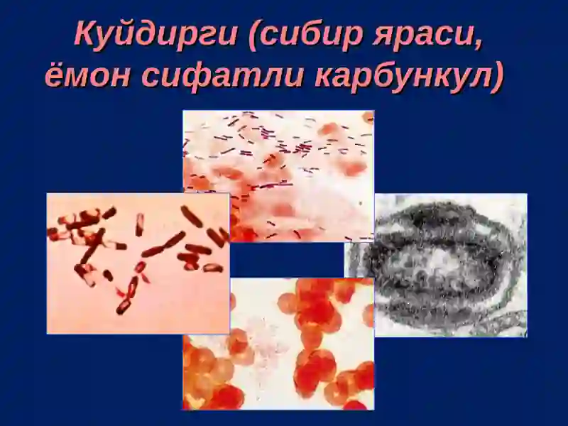 Куйдирги (Bacillus anthracis)