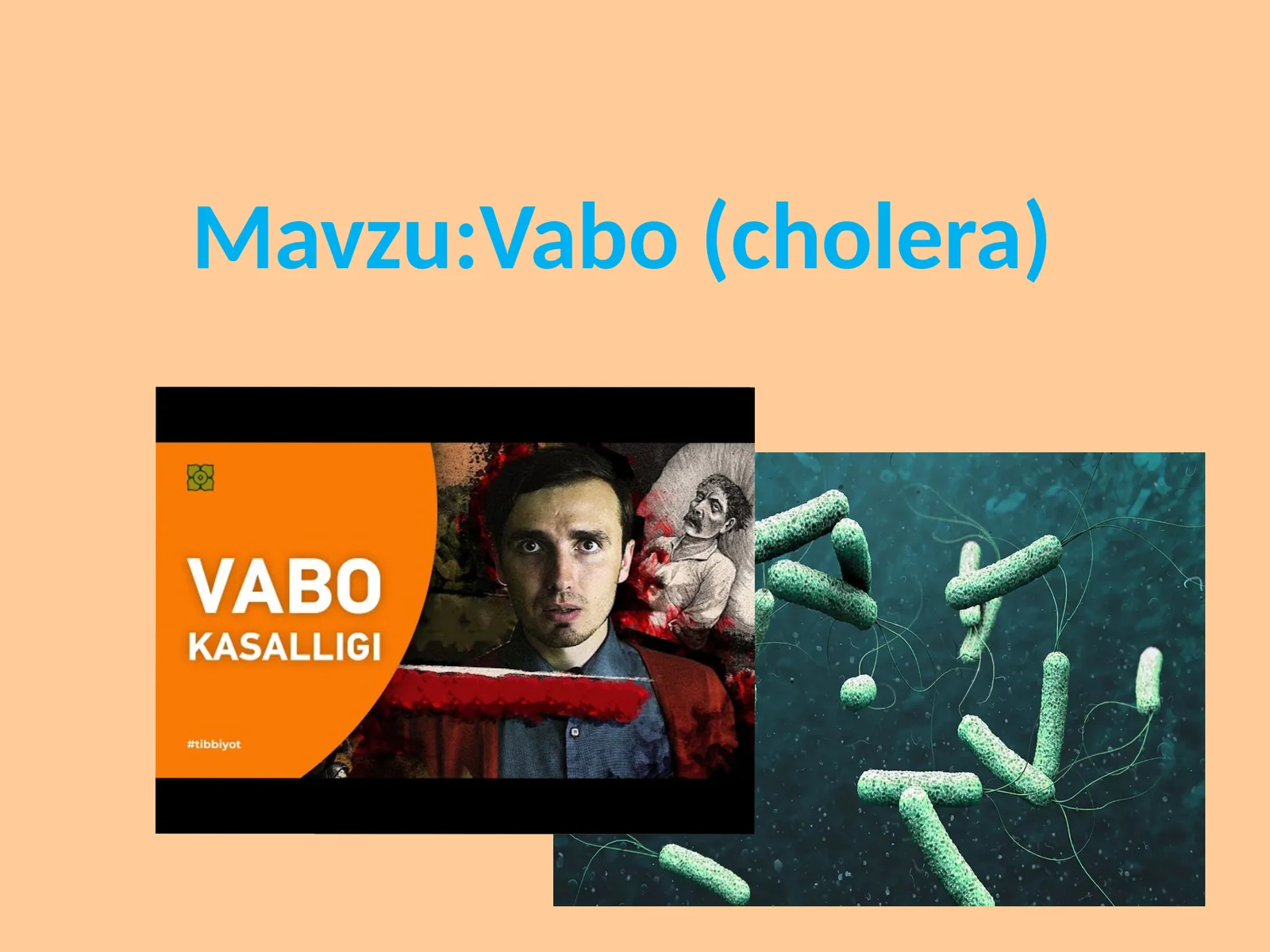 Vabo (cholera) 1