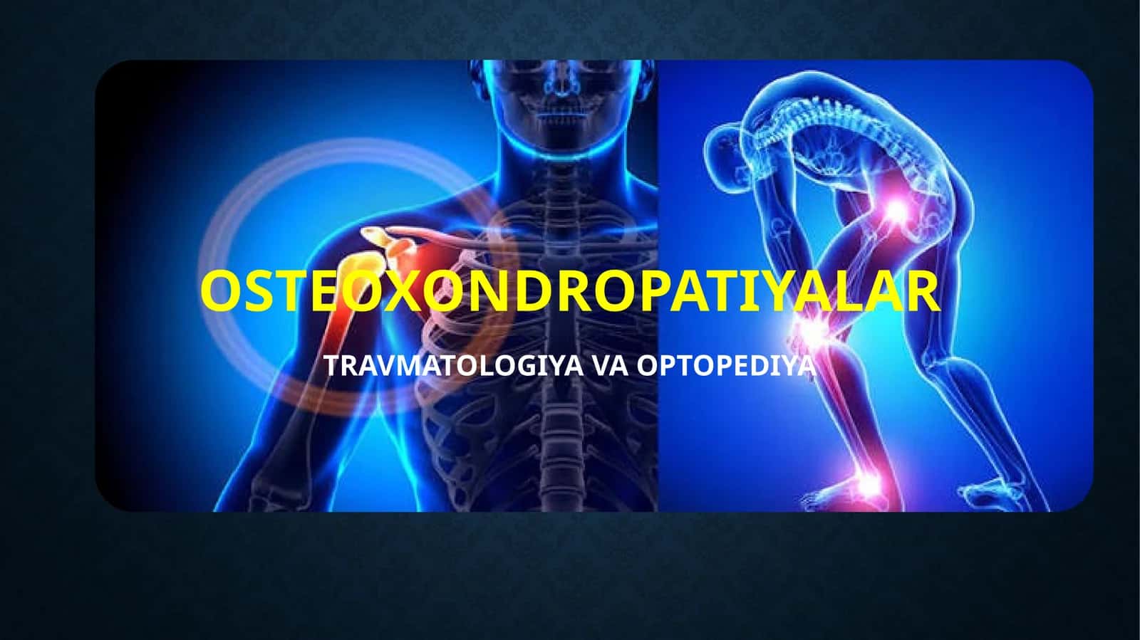 Osteoxondropatiyalar slayd (taqdimot) 1